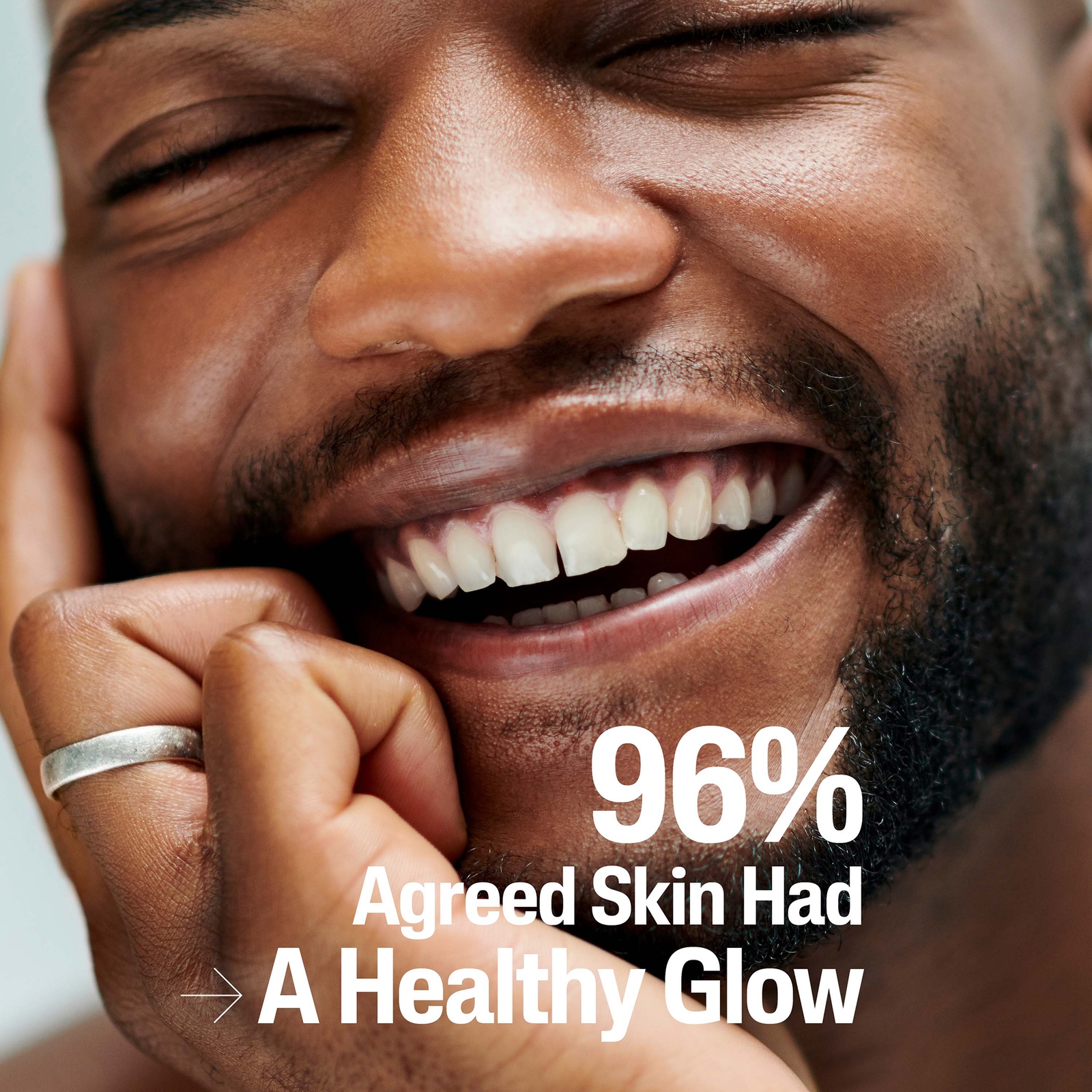 Thumbnail - Cetaphil Gentle Exfoliating Salicylic Lotion 236ml