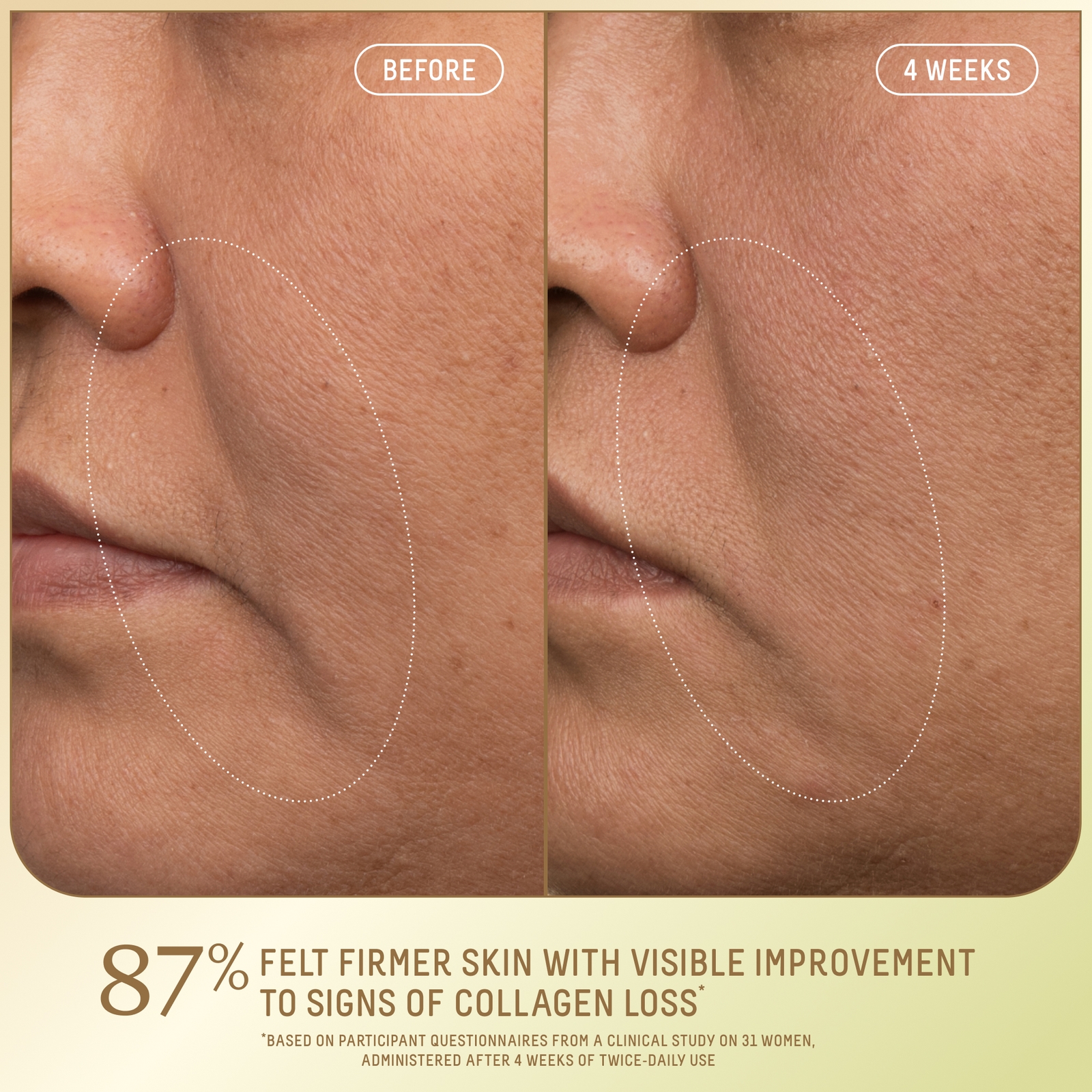 Thumbnail - SQUALANE + GROWTH FACTOR FIRMING MOISTURIZER 50ml FS FG