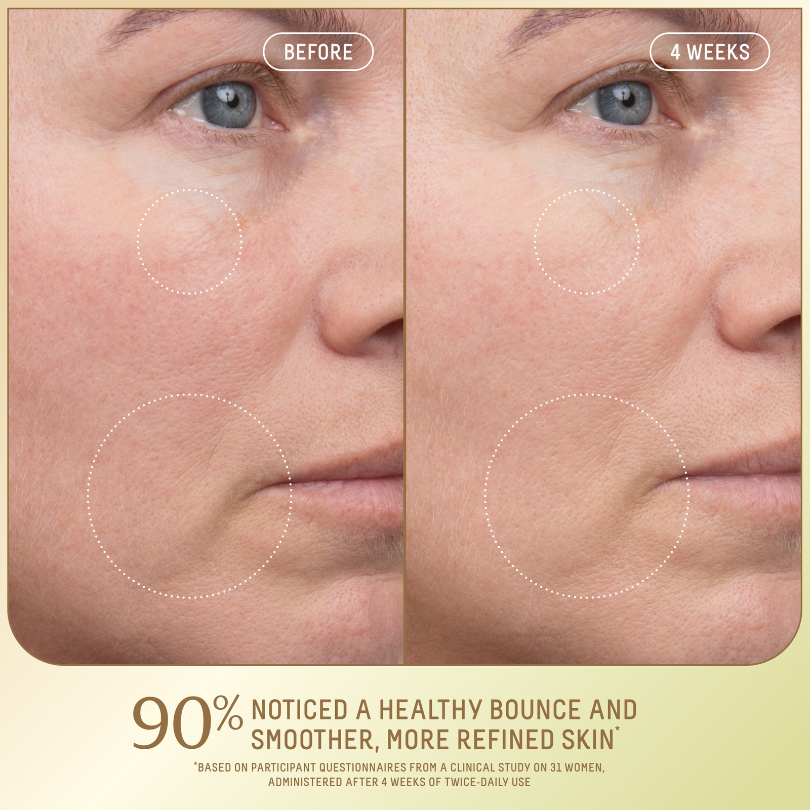 Thumbnail - SQUALANE + GROWTH FACTOR FIRMING MOISTURIZER 50ml FS FG