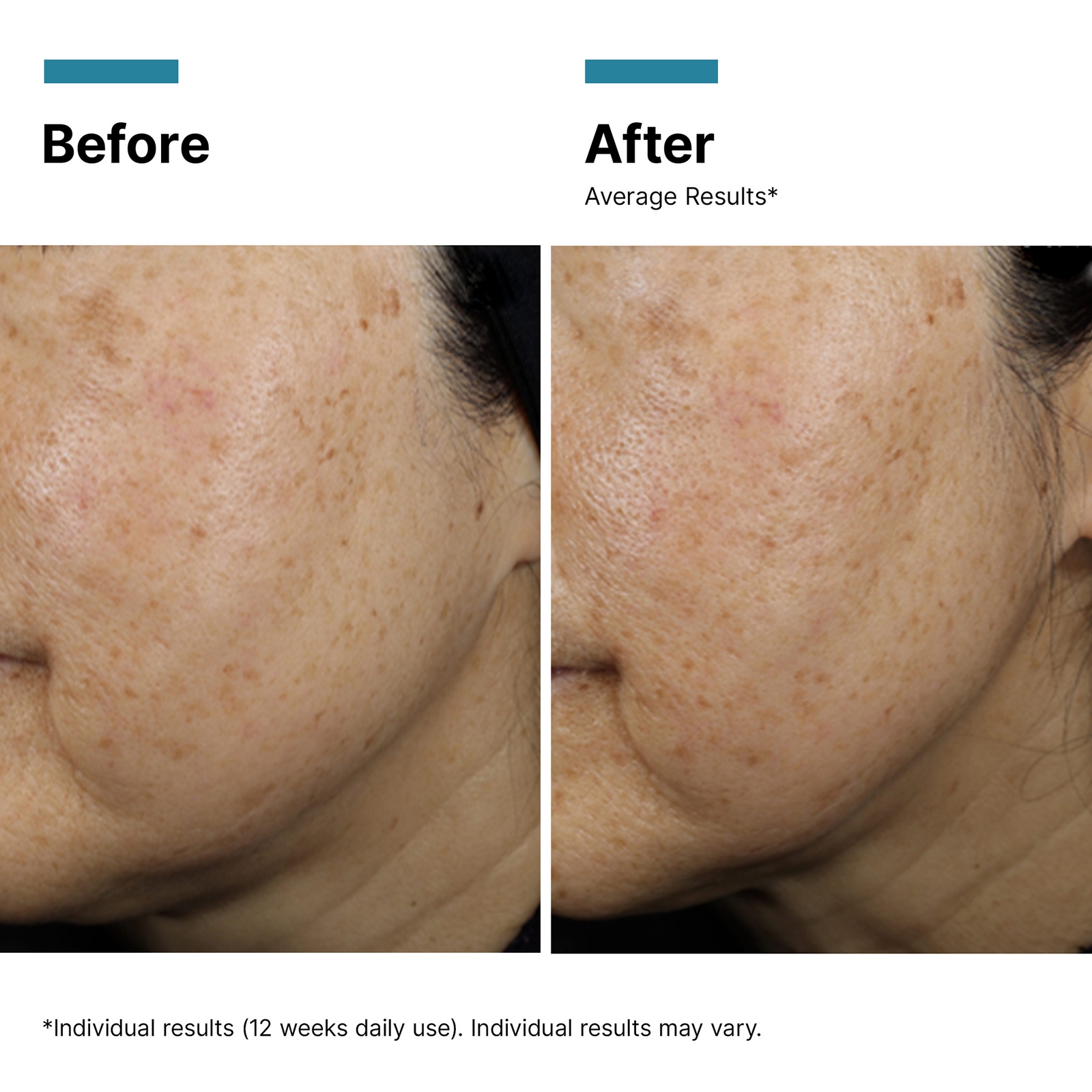 Thumbnail - SkinCeuticals A.G.E. Interrupter Ultra Serum 30ml