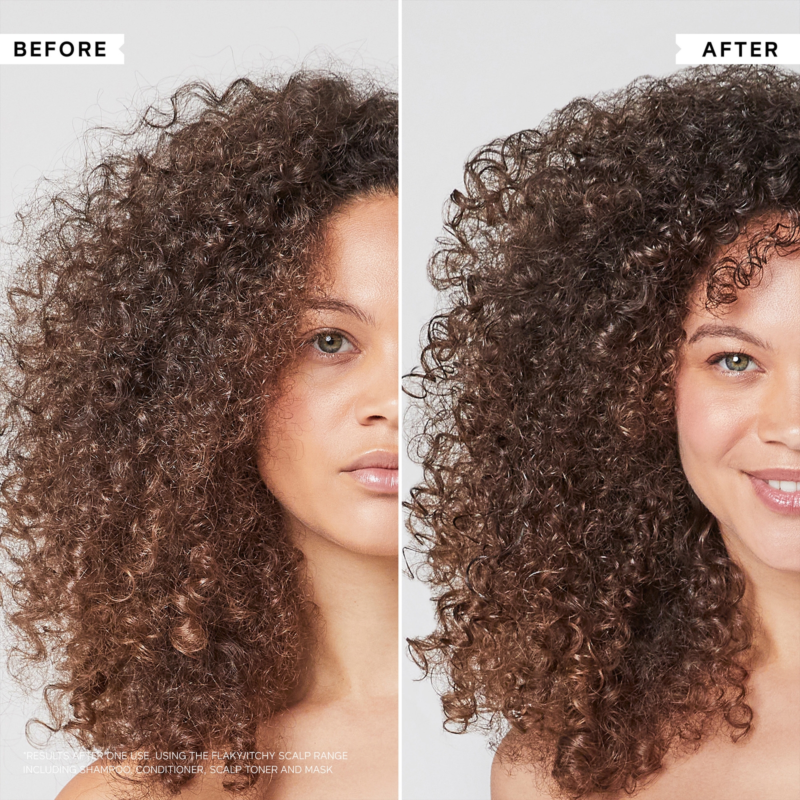 Thumbnail - Philip Kingsley Flaky/Itchy Scalp Hydrating Curl Anti-Dandruff Shampoo 75ml