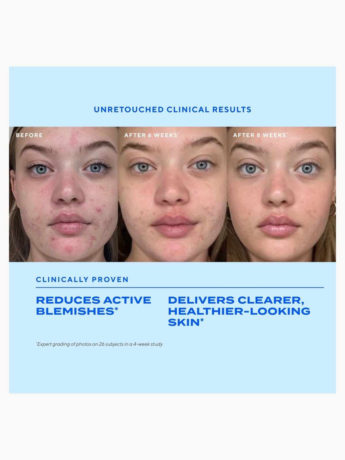 Murad Biome-Balancing Clear & Prevent Blemish Treatment Serum 30ml 2
