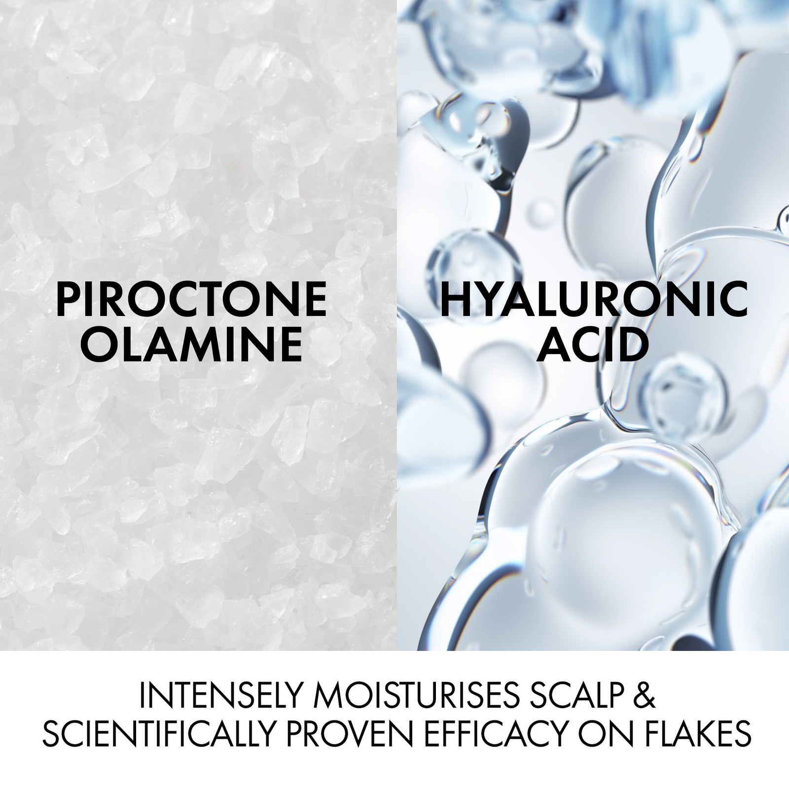 Thumbnail - Vichy Dercos Hair & Scalp Dermatological Conditioner for Hydration And Anti-Dandruff 200ml