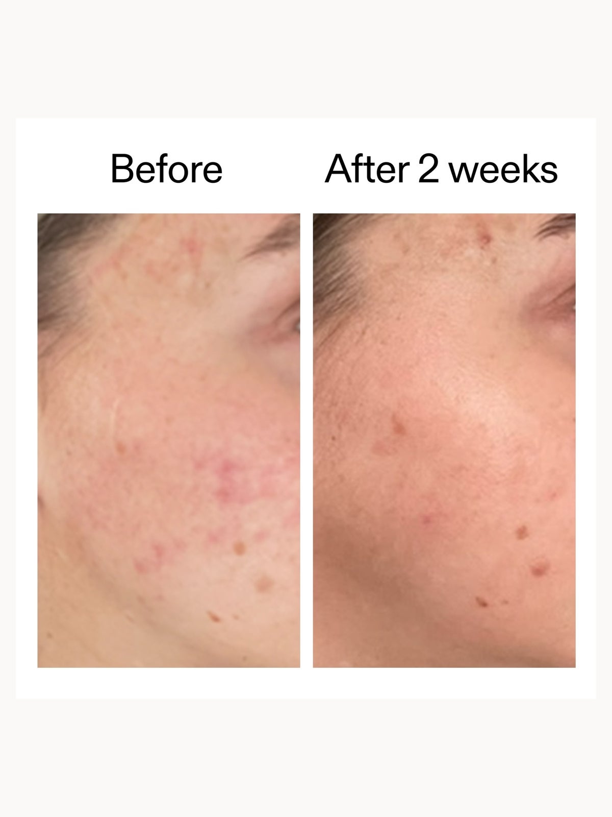 The INKEY List 360 Skin Clearing Serum 30ml 2