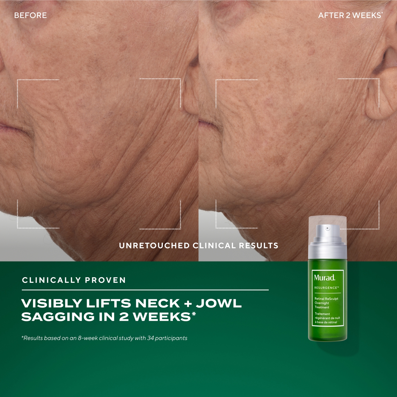 Thumbnail - Murad The Retinal Resculptors Set