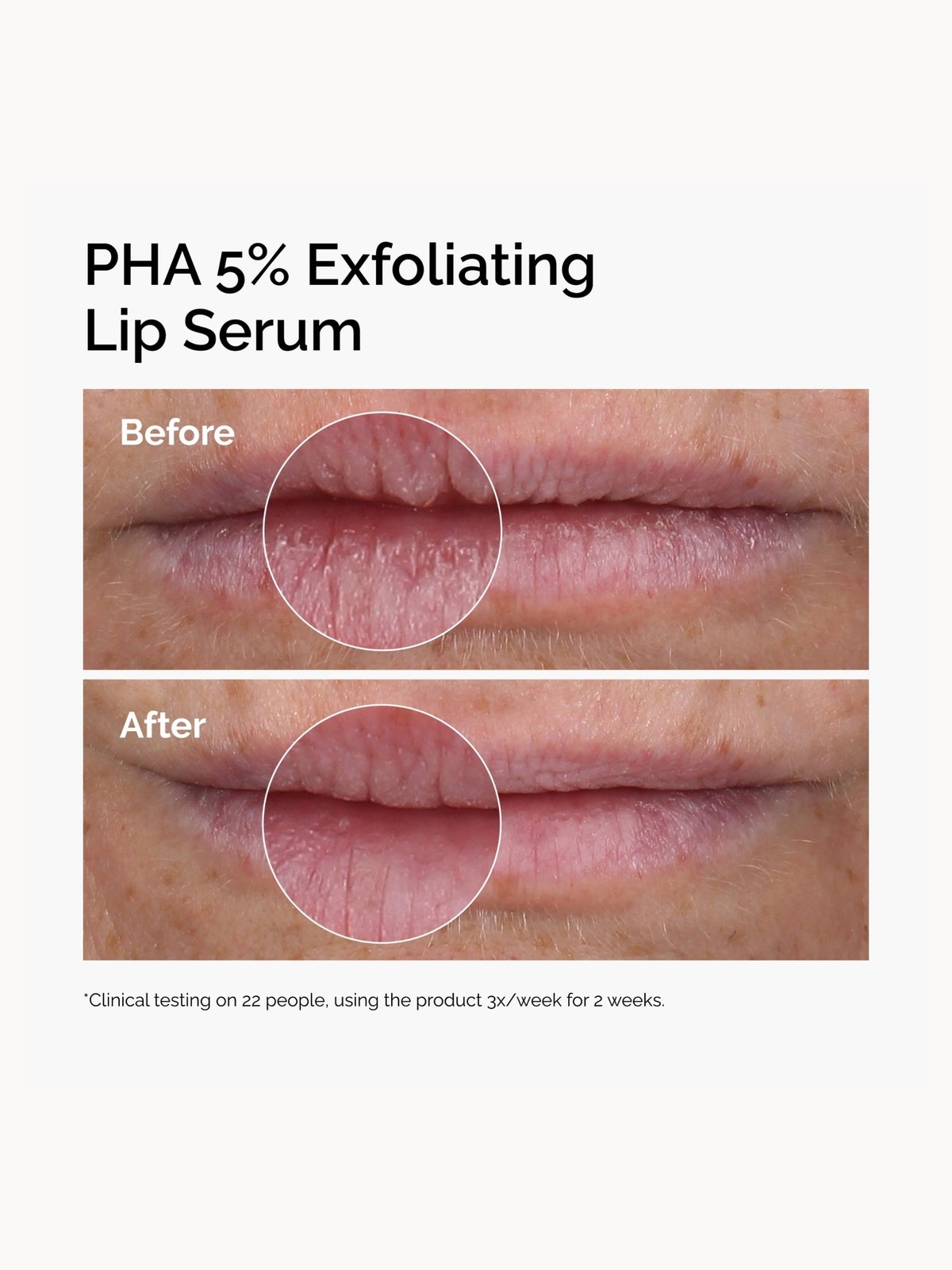 The Ordinary PHA 5% Exfoliating Lip Serum 15ml 3
