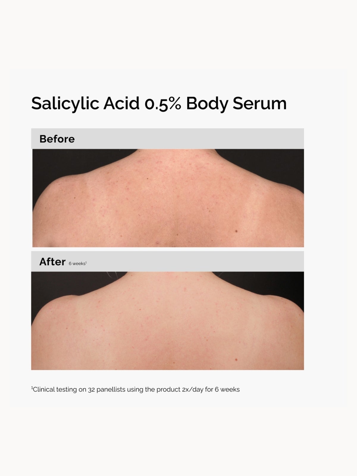 The Ordinary Body Care Routine for Smooth Skin with Salicylic Acid and Niacinamide 3