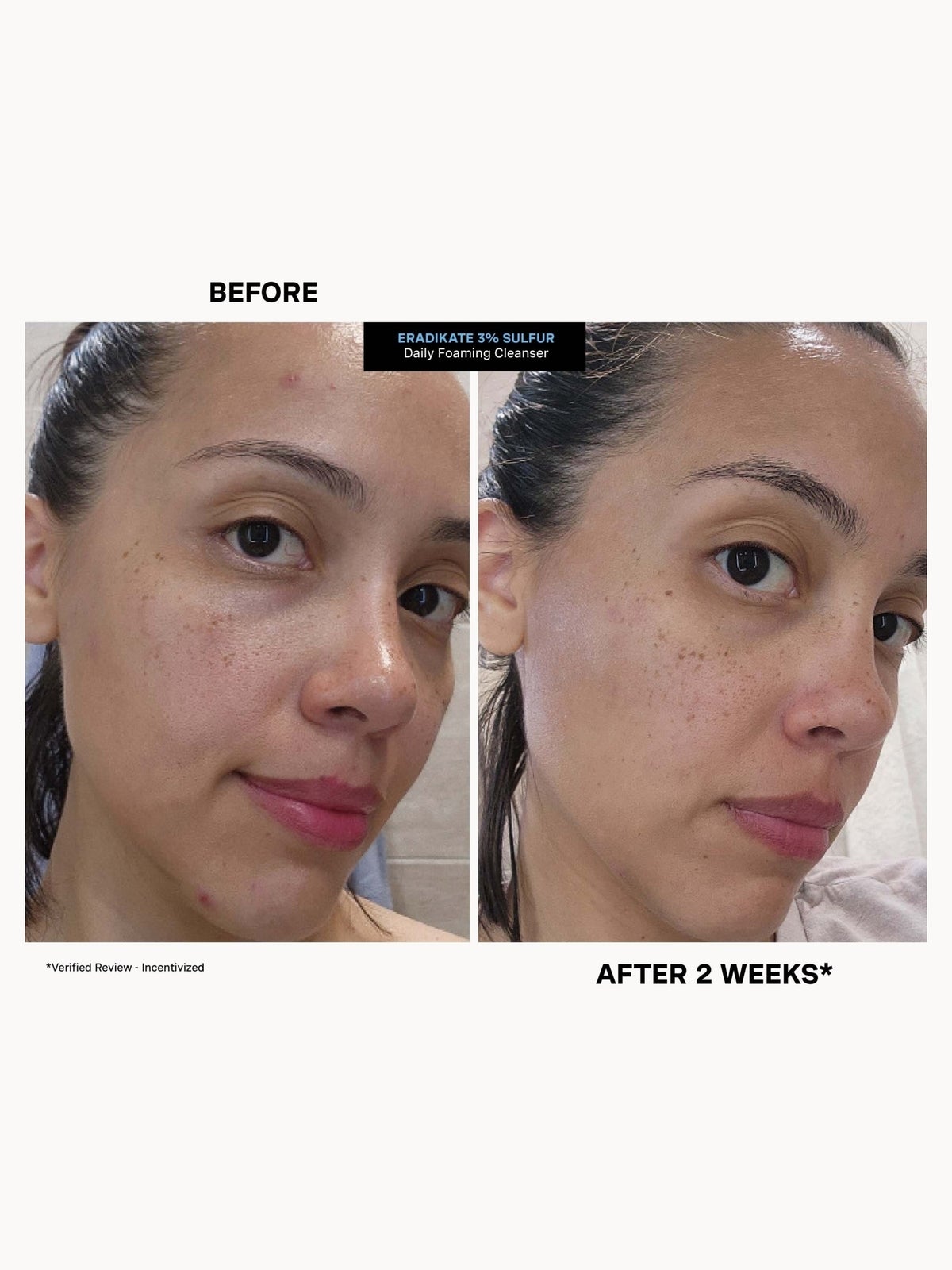 Kate Somerville Blemish Punisher Exclusive Kit 4
