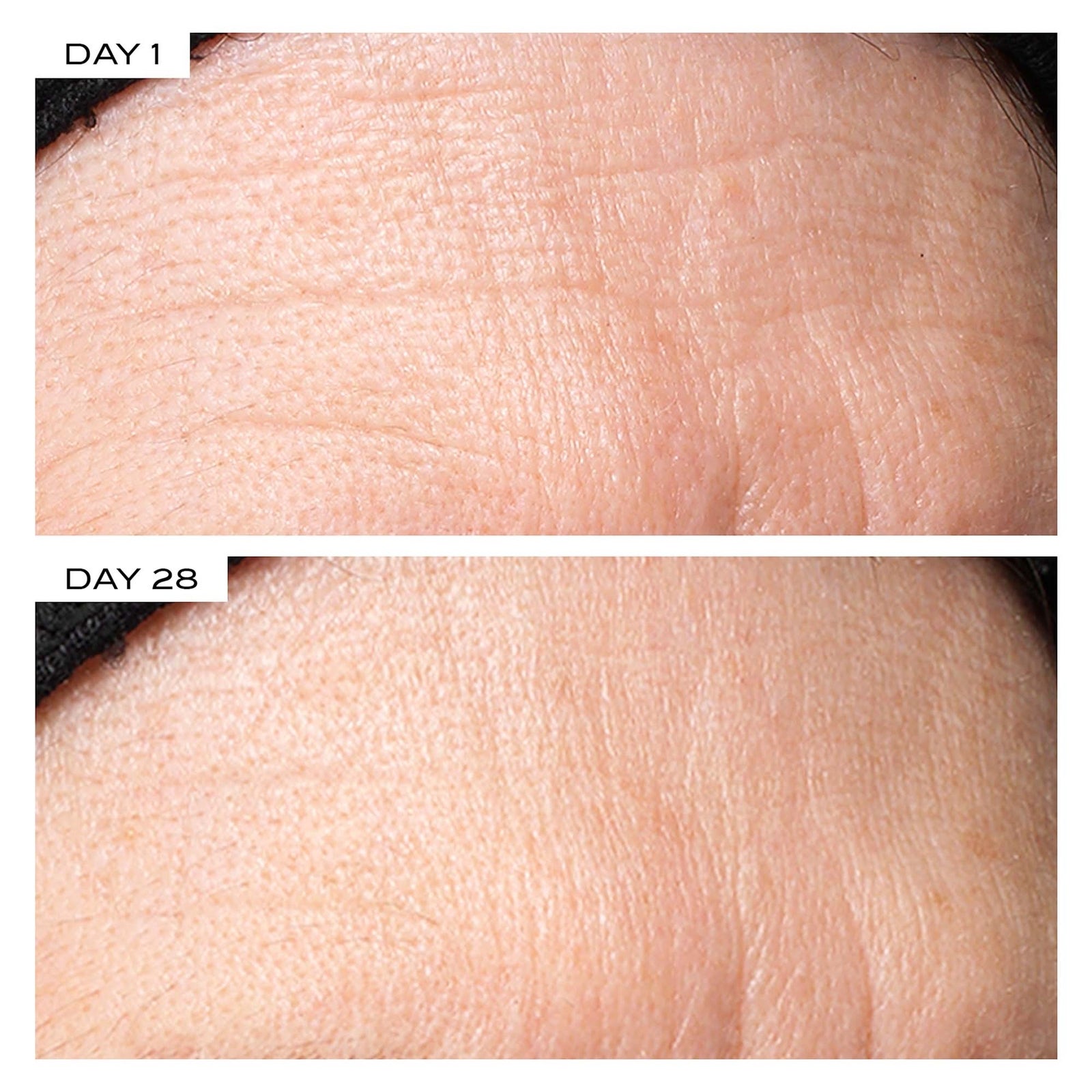 111SKIN Exosome Face Lift Protocol 2