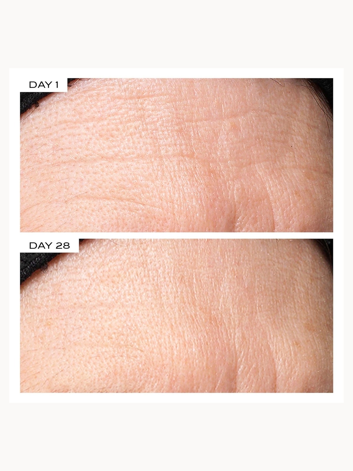 111SKIN Exosome Face Lift Protocol 2
