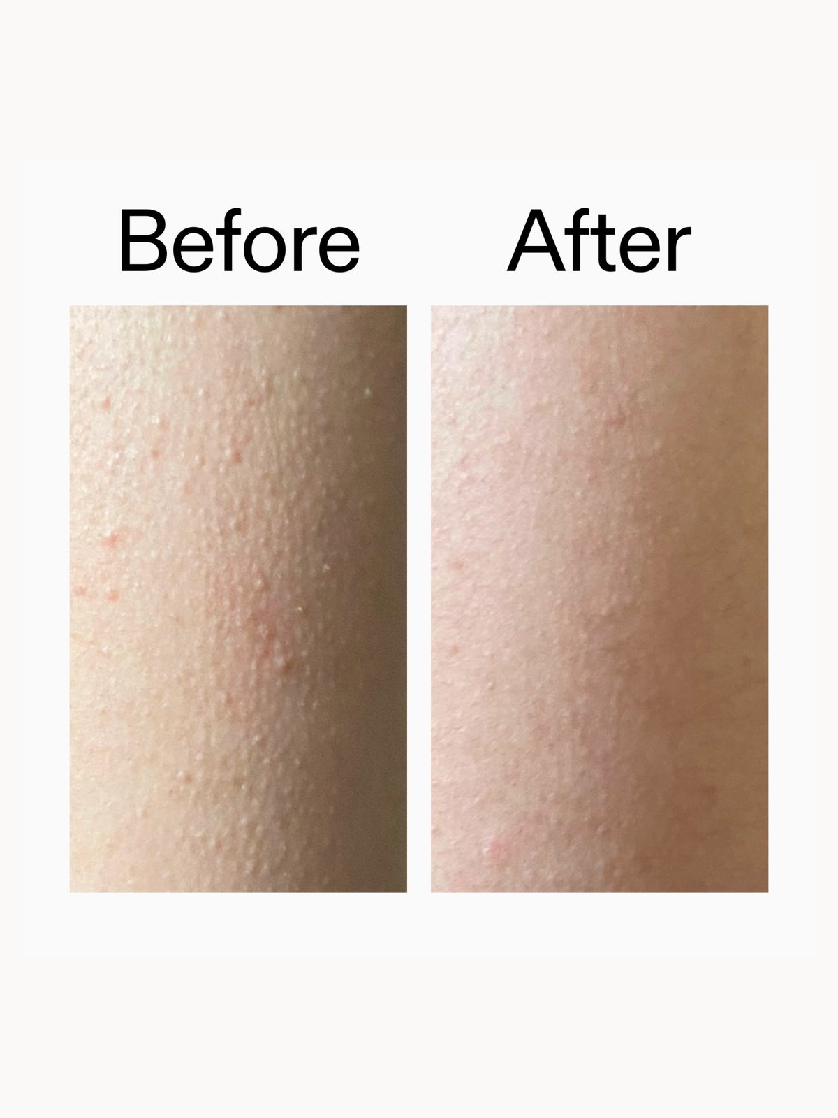 The INKEY List Smooth & Glow Body Duo 3