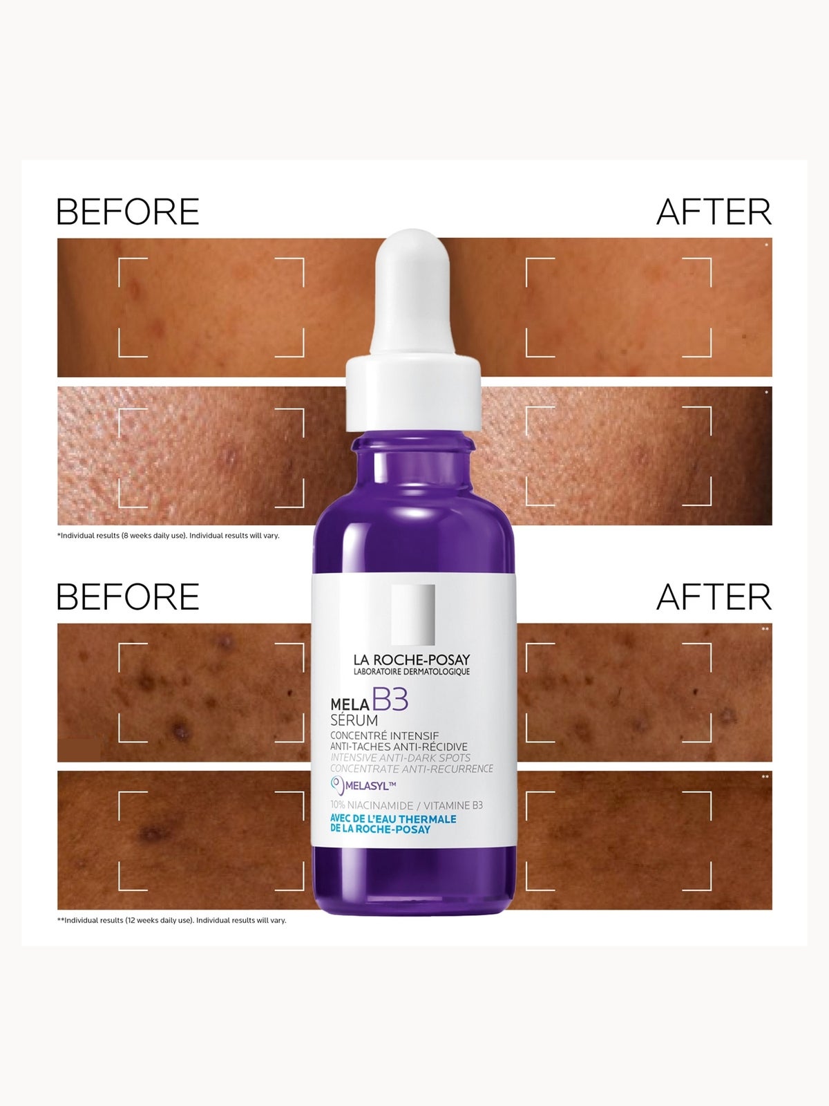 La Roche-Posay Anthelios Anti-Dark Spot Bundle 3
