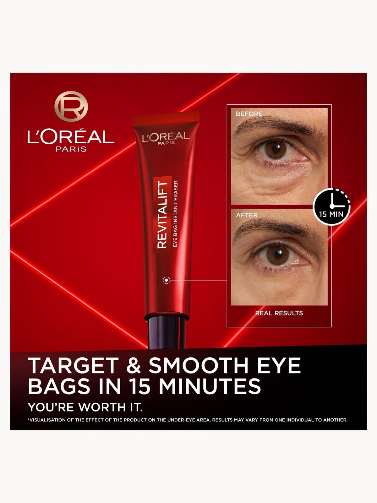 L'Oreal Paris Revitalift Laser Eye Bag Instant Eraser 15ml 2