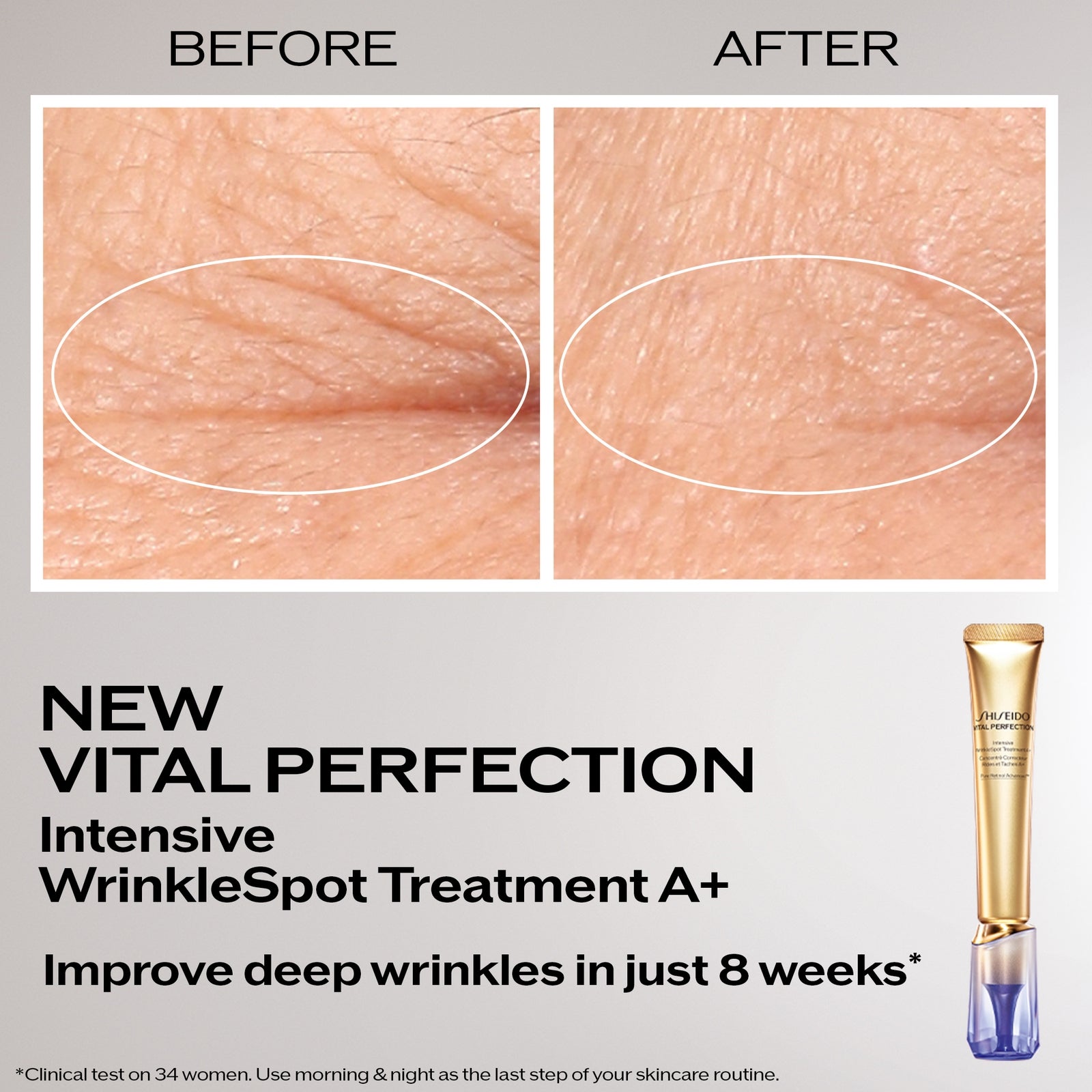 Shiseido Intensive WrinkleSpot Treatment A+ 20ml 2
