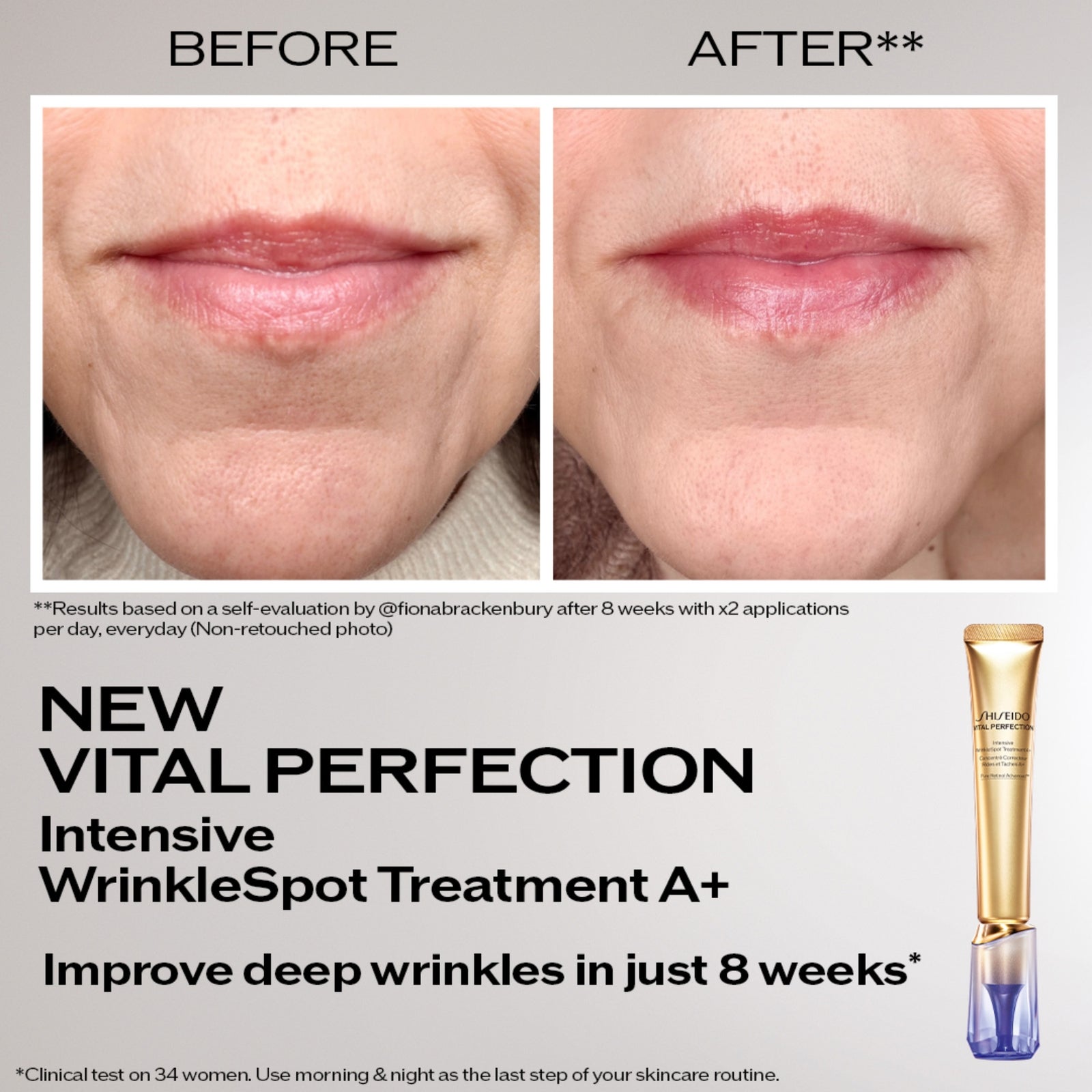 Shiseido Intensive WrinkleSpot Treatment A+ 20ml 3