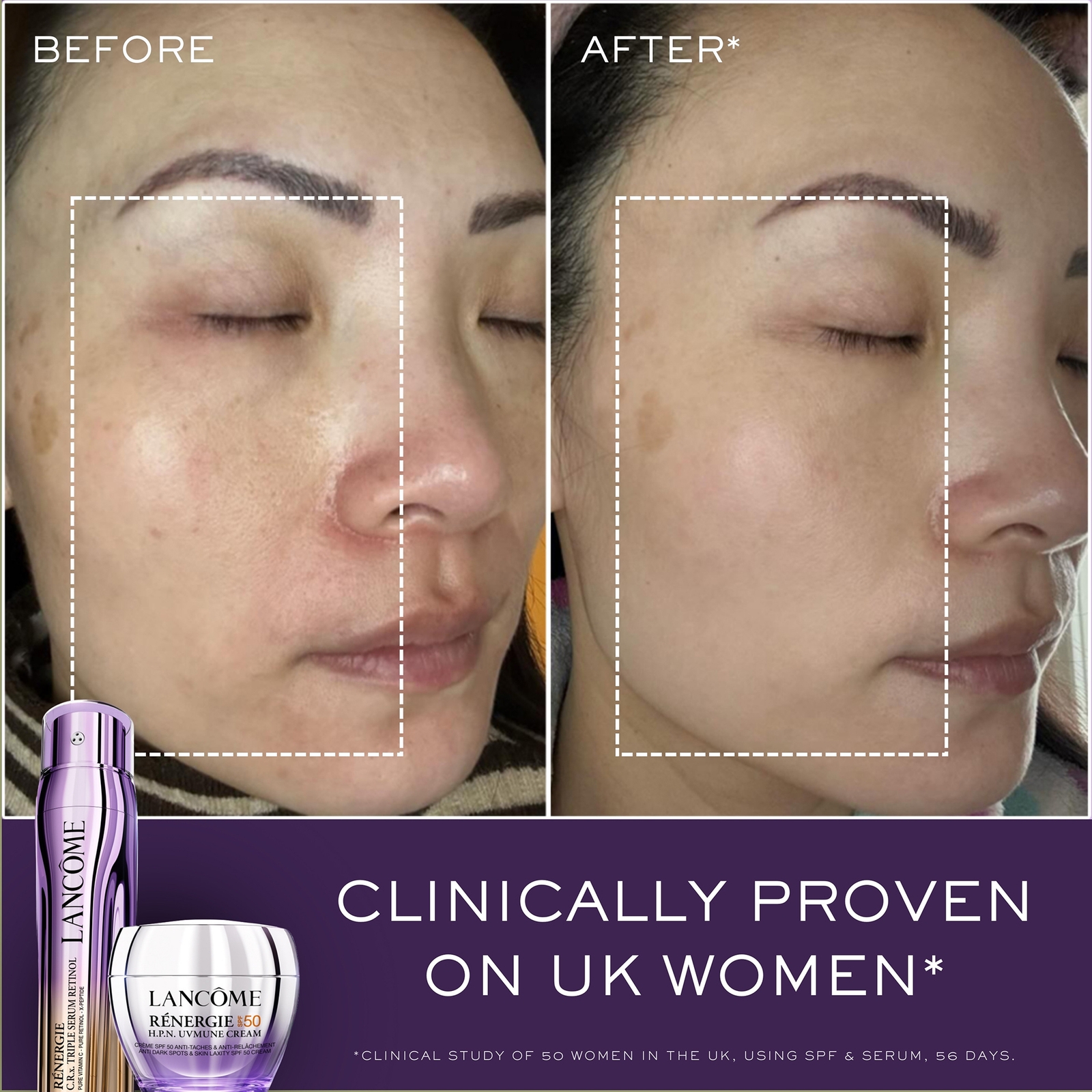 Thumbnail - Lancôme Renergie Triple Serum Retinol Routine Set