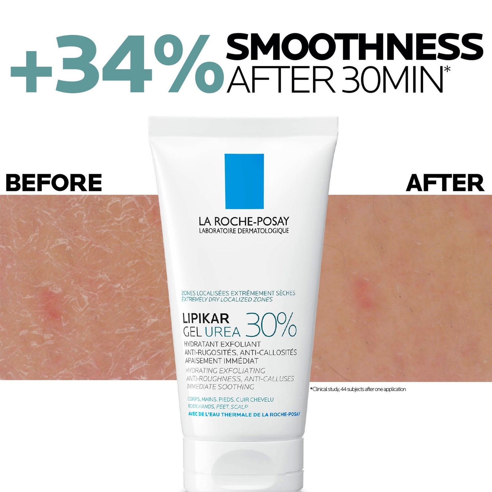 La Roche Posay Lipikar Urea 30% Exfoliating Moisturising Gel 50ml 4