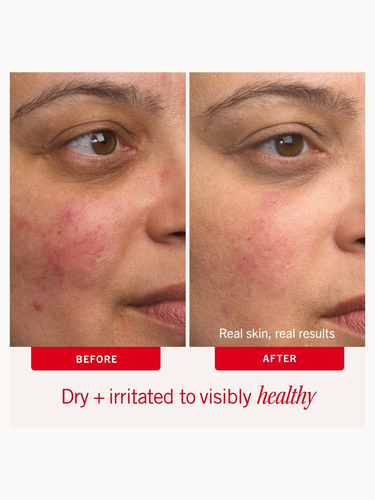 First Aid Beauty Ultra Repair Cream 56.7g 2