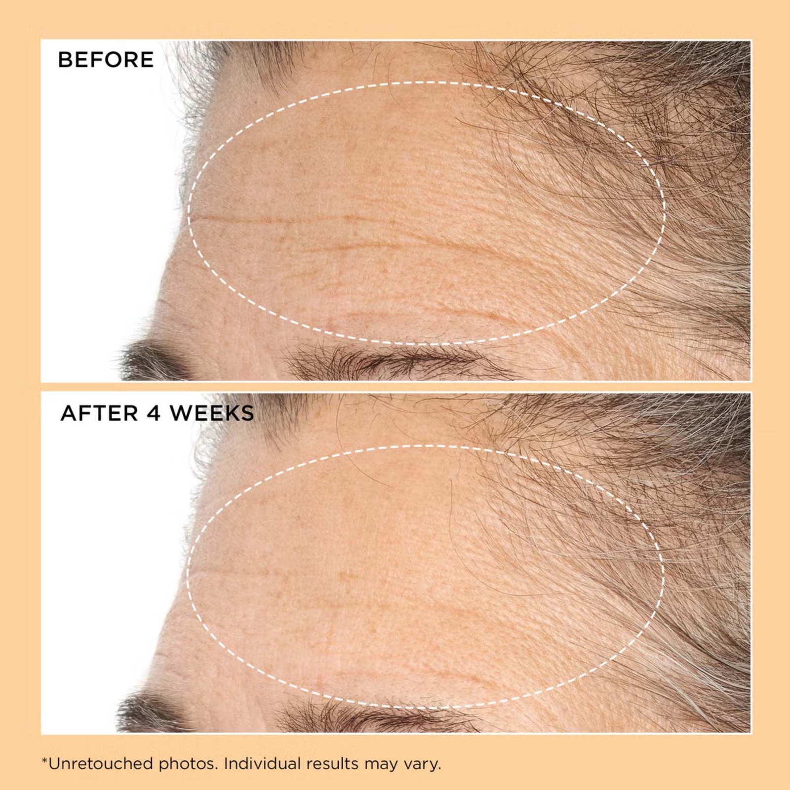 Thumbnail - Perricone MD Neuropeptide Duo