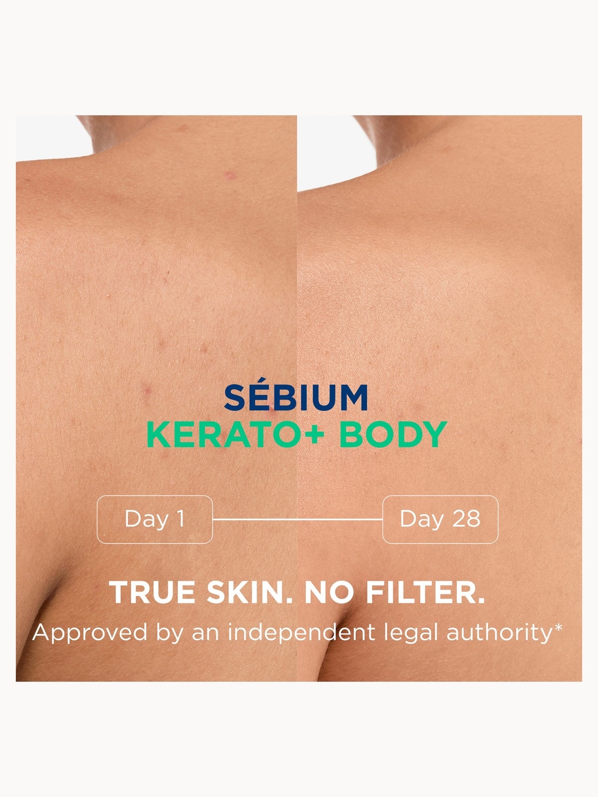 Bioderma Sebium Kerato+ Body Spray 150ml 4