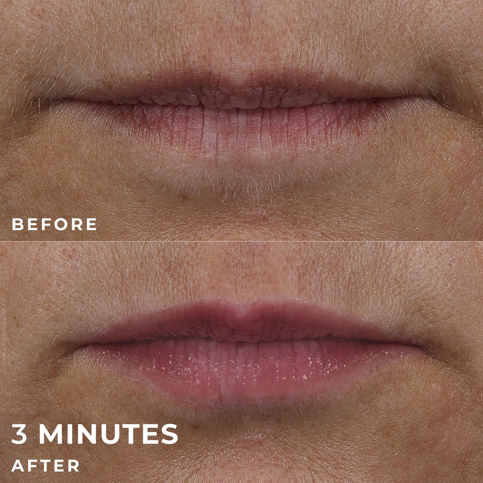 RoC Skincare Derm Correxion Lip Volumiser 10ml 3