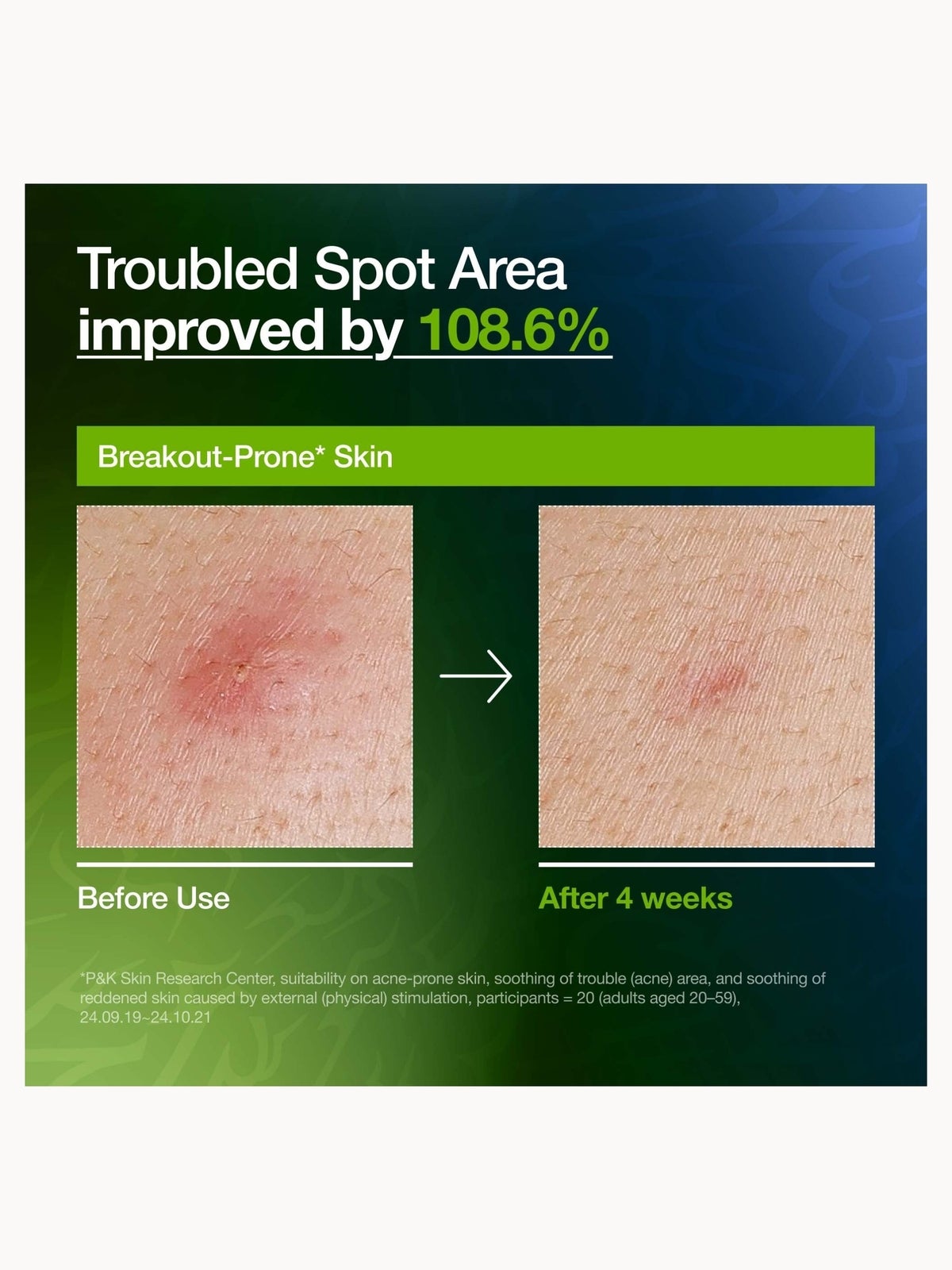 Exclusive Anua KPop Demon Hunters Azelaic Acid 10 Hyaluron Redness Soothing Serum 50ml 4