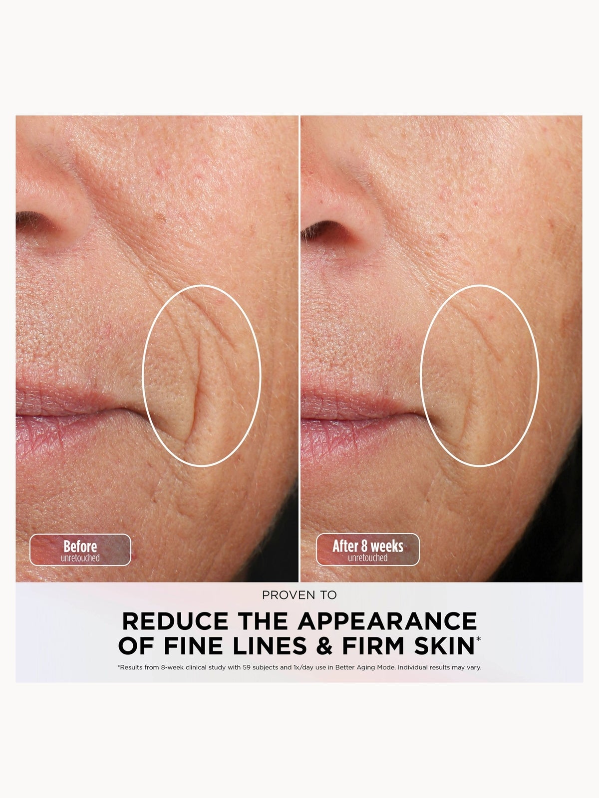 Shark CryoGlow LED Face Mask Under-Eye Cooling & Anti-Ageing & Blemish Repair - Strawberry Matcha, FW312UKGN, photo 2
