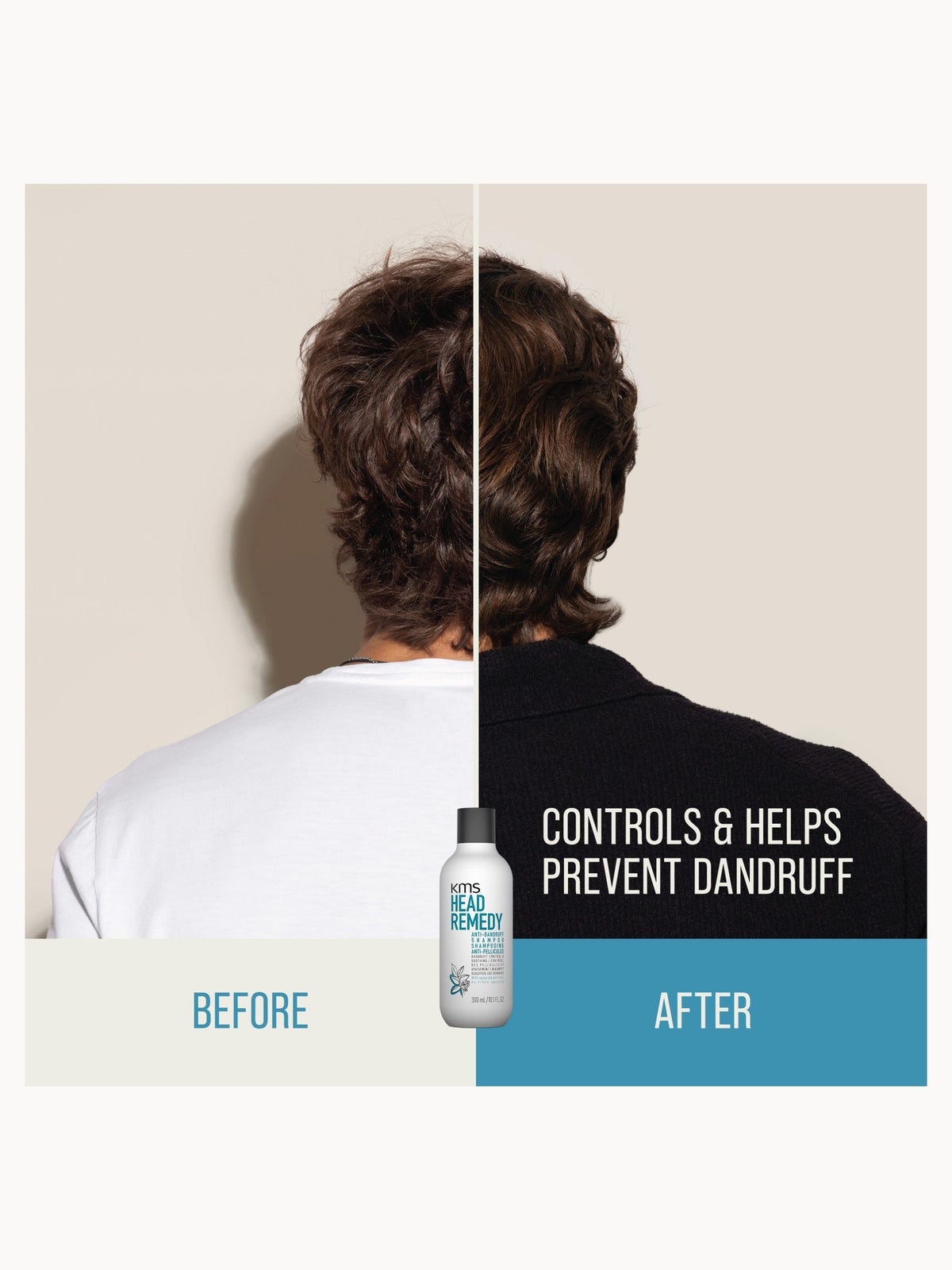 KMS HeadRemedy Anti-Dandruff Shampoo 300ml 3
