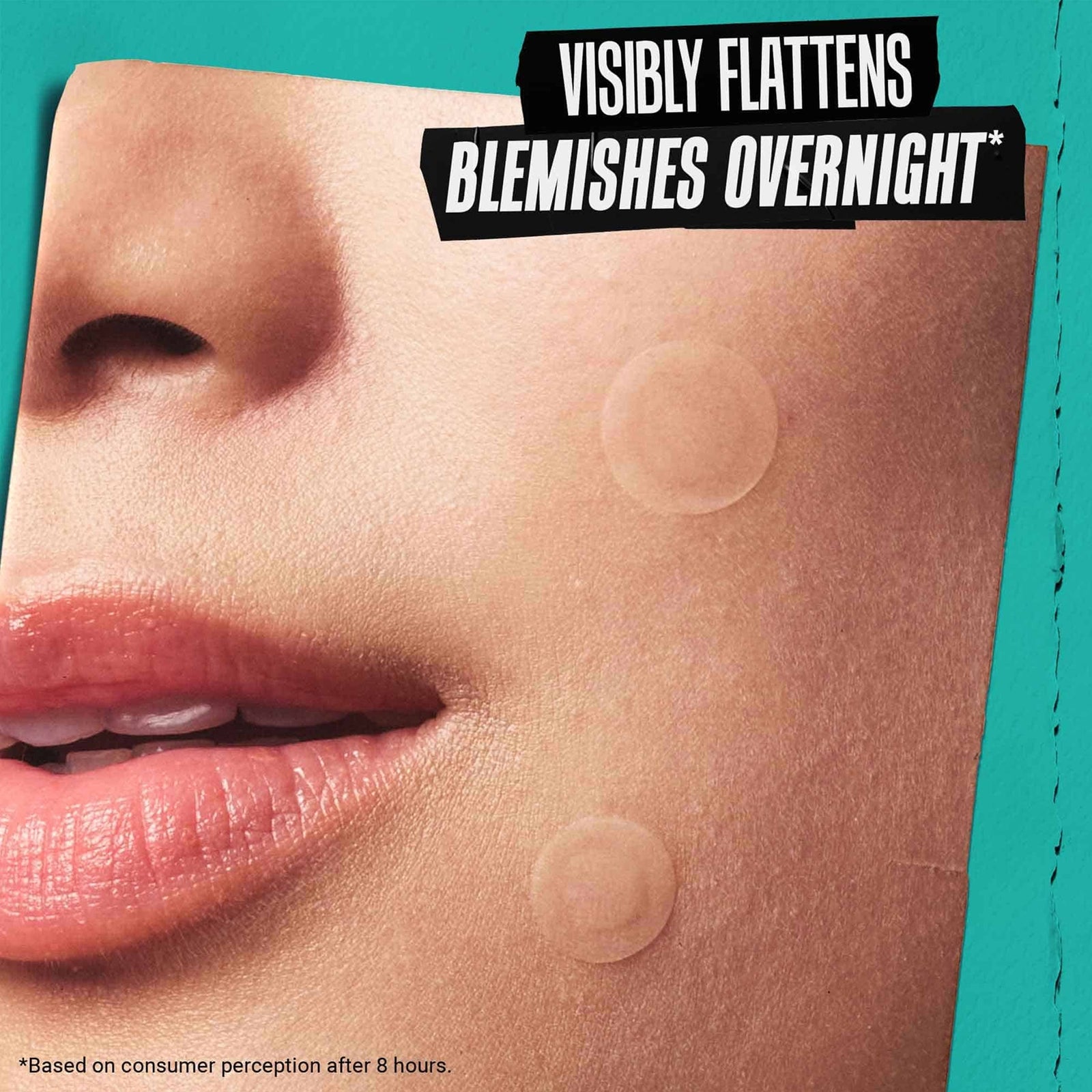 Kiehl's Truly Targeted Overnight Blemish Patches 3